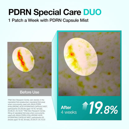 ANUA_Salmon_DNA_PDRN_Collagen_Melting_Patch_for_Glass_skin,_Smile_Line_Patches,_Wrinkle_Patches,_Melting_Thin_Collagen_Patch,_Firming_for_Fine_Lines,_Glow,_Korean_Skincare,_2_Pairs_x_4EA,_Patch_Only