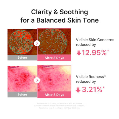 medicube_PDRN_Pink_Peptide_Serum_with_Salmon_DNA_|_Ultra_Light_Hydrating_Serum_with_Hyaluronic_Acid_|_Fast-Absorbing_Glow_Care_for_Skin_Clarity_|_Korean_Skincare,_1.01_fl._Oz