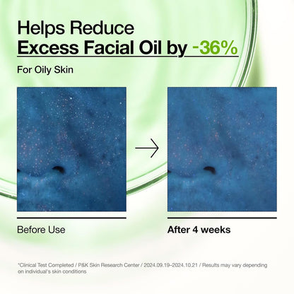 Anua_Azelaic_Acid_10_Hyaluron_Redness_Soothing_Serum,_Facial_Serum_for_Blemish-Prone_&_Oily-Prone_Skin,_Lightweight_&_Hydrating_Blemish_Care,_Hyaluronic_Acid,_Korean_Skincare,_1.01_fl_oz.