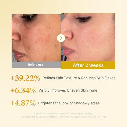 medicube_Kojic_Acid_Turmeric_Smoothing_Toner_for_Face_&_Body_|_Lightweight_Toner_for_Balancing_Uneven_Skin_Tone_&_Texture_|_Niacinamide,_Glycolic_Acid_for_Clear_Glass_Skin_|_8.45_fl.oz