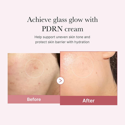 medicube_PDRN_Pink_Hyaluronic_Moisturizing_Cream_|_Blemish_Recovery,_Relief_&_Hydrating_Care_|_Restores_Skin_Elasticity_&_Glow_|_Korean_Skincare_for_Even_Skin_Tone_&_Pore_Care_|_50ml_/_1.69_fl.oz.