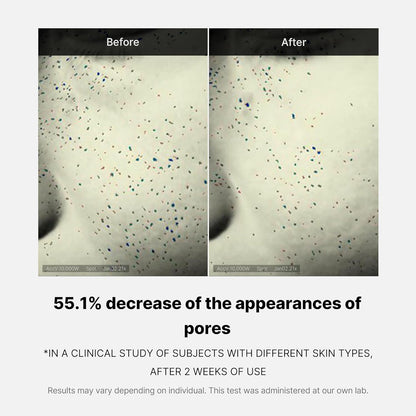 Medicube_Zero_Pore_One-Day_Cream_1.69_fl.oz_-_Visibly_Smaller_Pores,_Controls_Excess_Oil_-_Pore_Refining_Cream_with_Panthenol,_Salicylic_Acid,_and_Niacinamide_-_Korean_Skincare