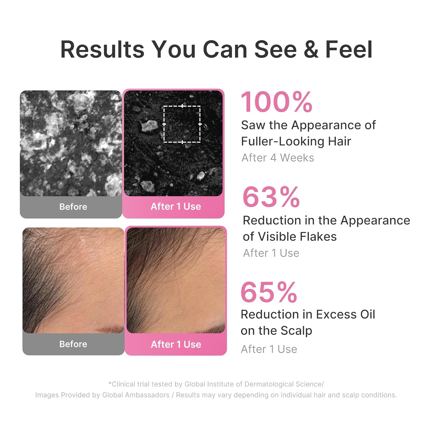 medicube_Rosemary_PDRN_Clarifying_Thickening_Shampoo_|_Cooling,_Clarifying_Care_for_Thinning,_Weak_&_Flaky_Hair_|_Amino_Acid_Complex_for_Stronger,_Thicker-Looking_Hair_|_Korean_Hair_Care,_13.52_fl.oz