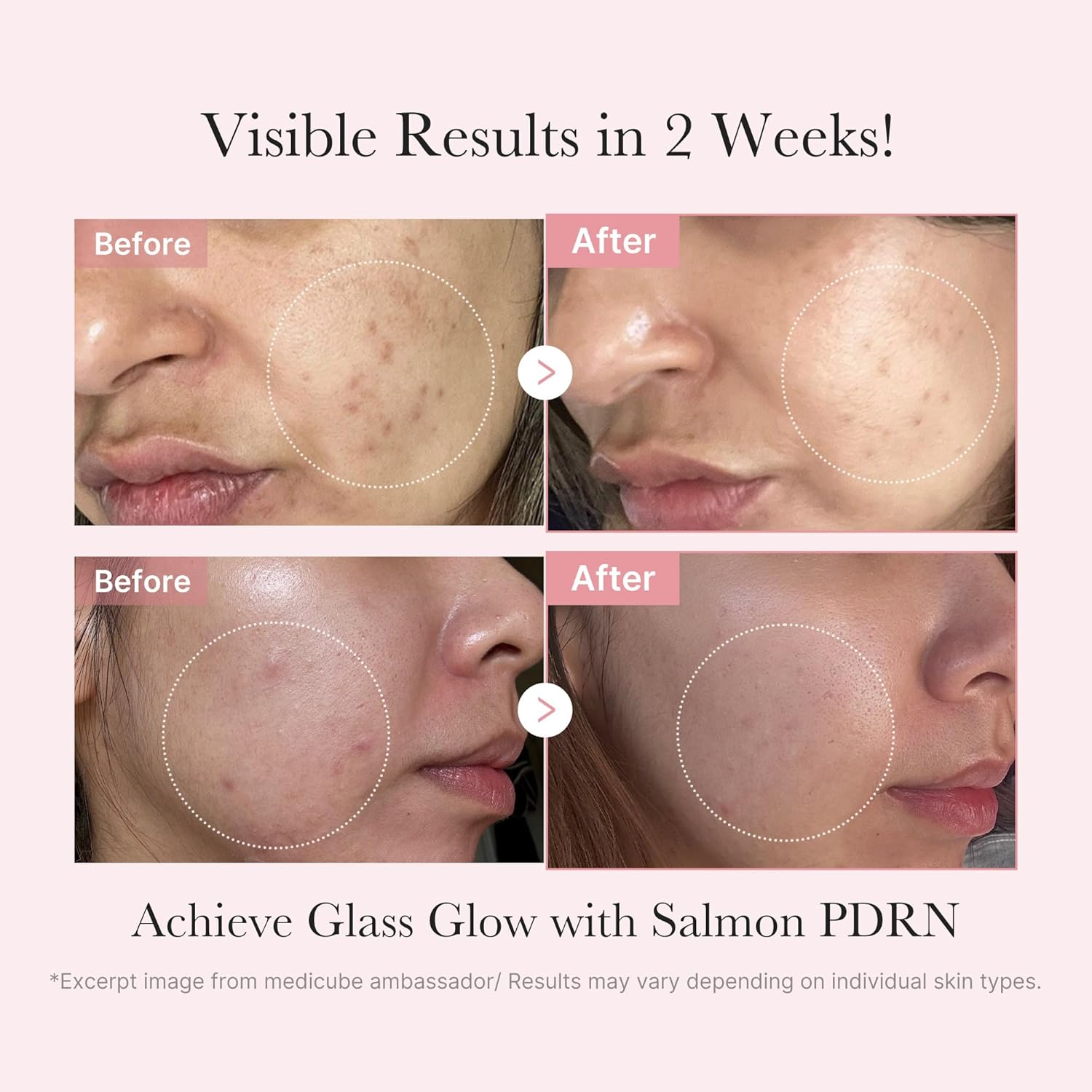 medicube_Salmon_DNA_PDRN_Trial_Kit_|_Glass_Glow_Mini_Skincare_Set_with_Toner,_Serum_&_Sheet_Mask_for_Hydrating,_Firming,_Moisturizing_|Gift_&_Travel_Essentials_for_Women_&_Girls_|_Korean_Skincare