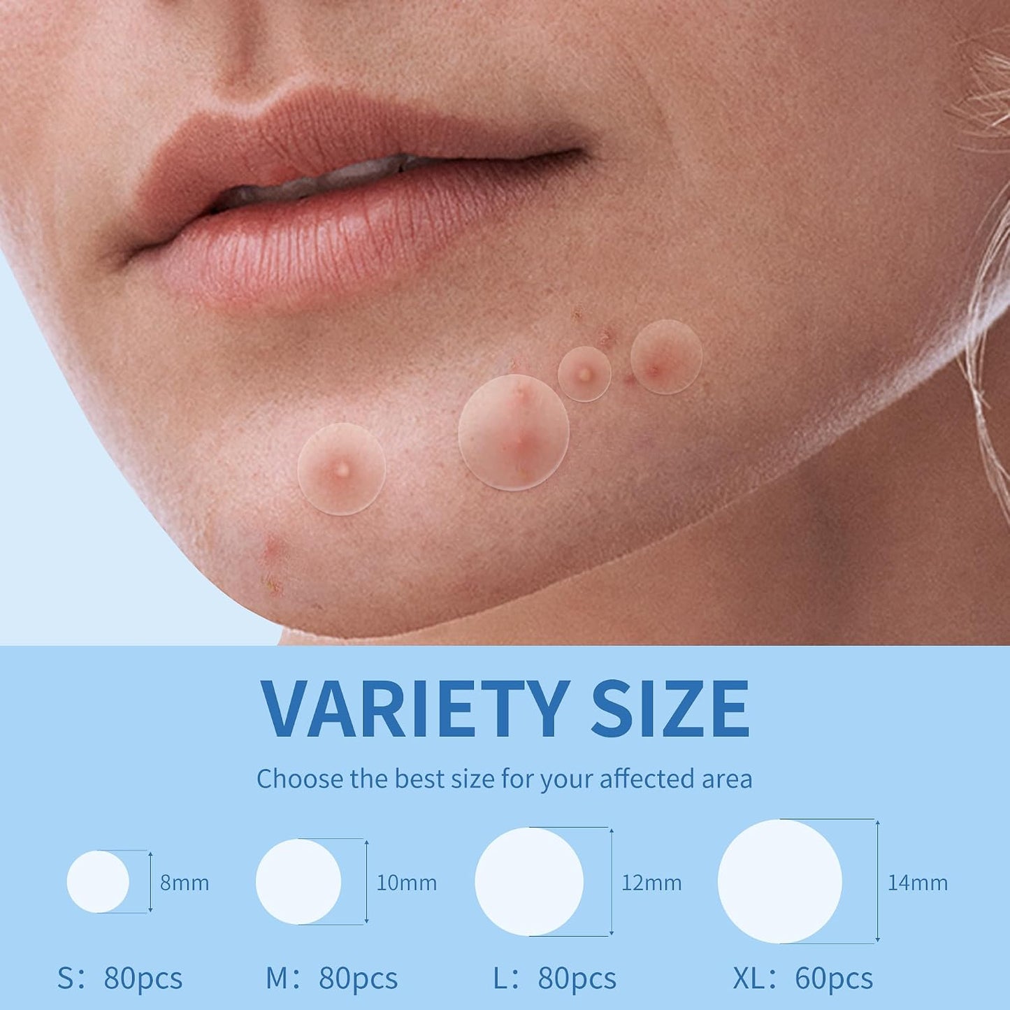 Pimple_Patches_for_Face,_4_Size_300_Counts_Acne_Patches,_Hydrocolloid_Patches_for_Covering_Zits_and_Blemishes,_Spot_Stickers_with_Salicylic_Acid,_Tea_Tree_Oil_&_Calendula_Oil