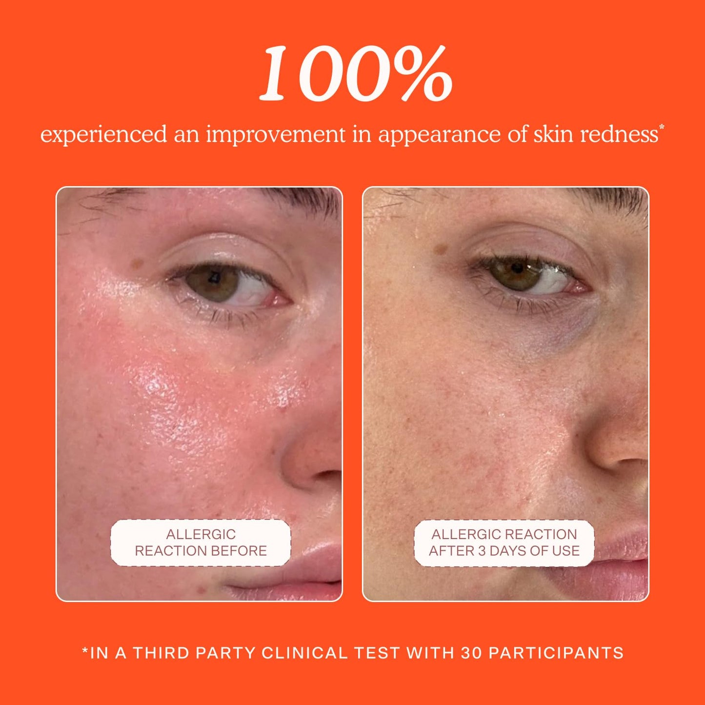 Tower_28_SOS_Daily_Rescue_Facial_Spray_-_Hypochlorous_Acid_Spray_to_Help_Reduce_Redness,_Calm_Irritation_+_Alleviate_Flare-Ups_-_Soothing_+_Purifying_Face_Toner_-_Everyday_Skin_Care_Essential_(4_oz)