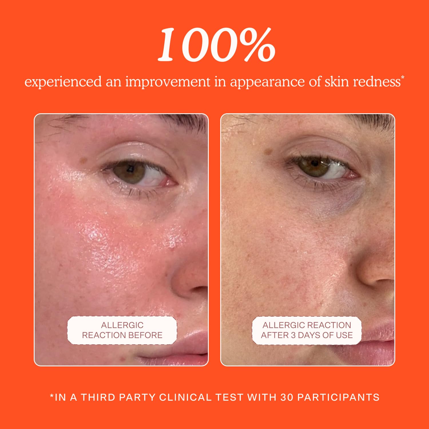 Tower_28_SOS_Daily_Rescue_Facial_Spray_-_Hypochlorous_Acid_Spray_to_Help_Reduce_Redness,_Calm_Irritation_+_Alleviate_Flare-Ups_-_Soothing_+_Purifying_Face_Toner_-_Everyday_Skin_Care_Essential_(4_oz)