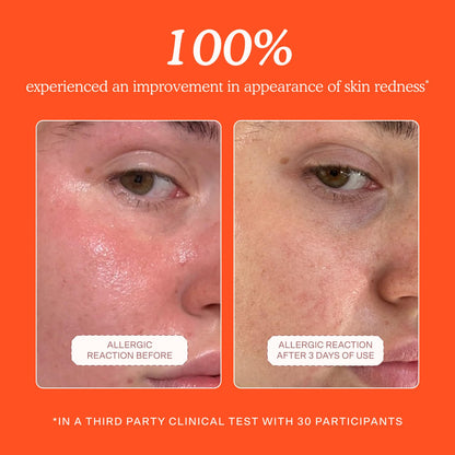 Tower_28_SOS_Daily_Rescue_Facial_Spray_-_Hypochlorous_Acid_Spray_to_Help_Reduce_Redness,_Calm_Irritation_+_Alleviate_Flare-Ups_-_Soothing_+_Purifying_Face_Toner_-_Everyday_Skin_Care_Essential_(4_oz)