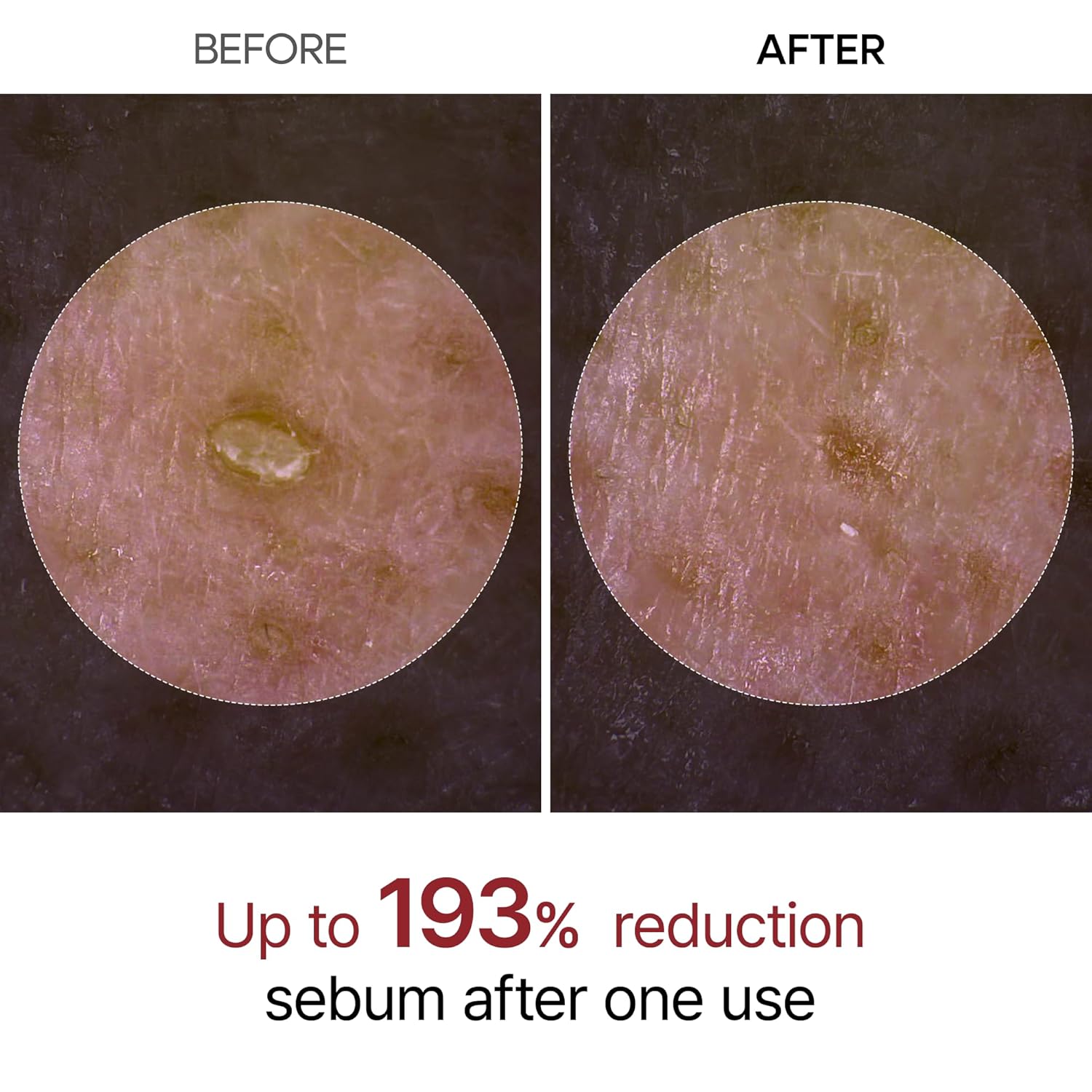 Dr.Melaxin_Peel_Shot_Glow_White_Rice_Peeling_Ampoule_80ml,_Dead_Skin_Gentle_Exfoliating_Ampoule_with_Rice_Water_Extract,_AHA_BHA,_Niacinamide,_Daily_Skin_Texture_Care,_All_Skin_Types,_Korean_Skincare