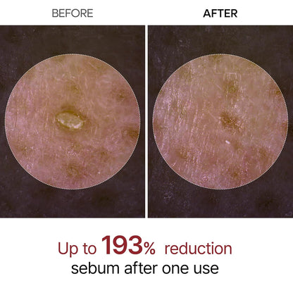Dr.Melaxin_Peel_Shot_Glow_White_Rice_Peeling_Ampoule_80ml,_Dead_Skin_Gentle_Exfoliating_Ampoule_with_Rice_Water_Extract,_AHA_BHA,_Niacinamide,_Daily_Skin_Texture_Care,_All_Skin_Types,_Korean_Skincare