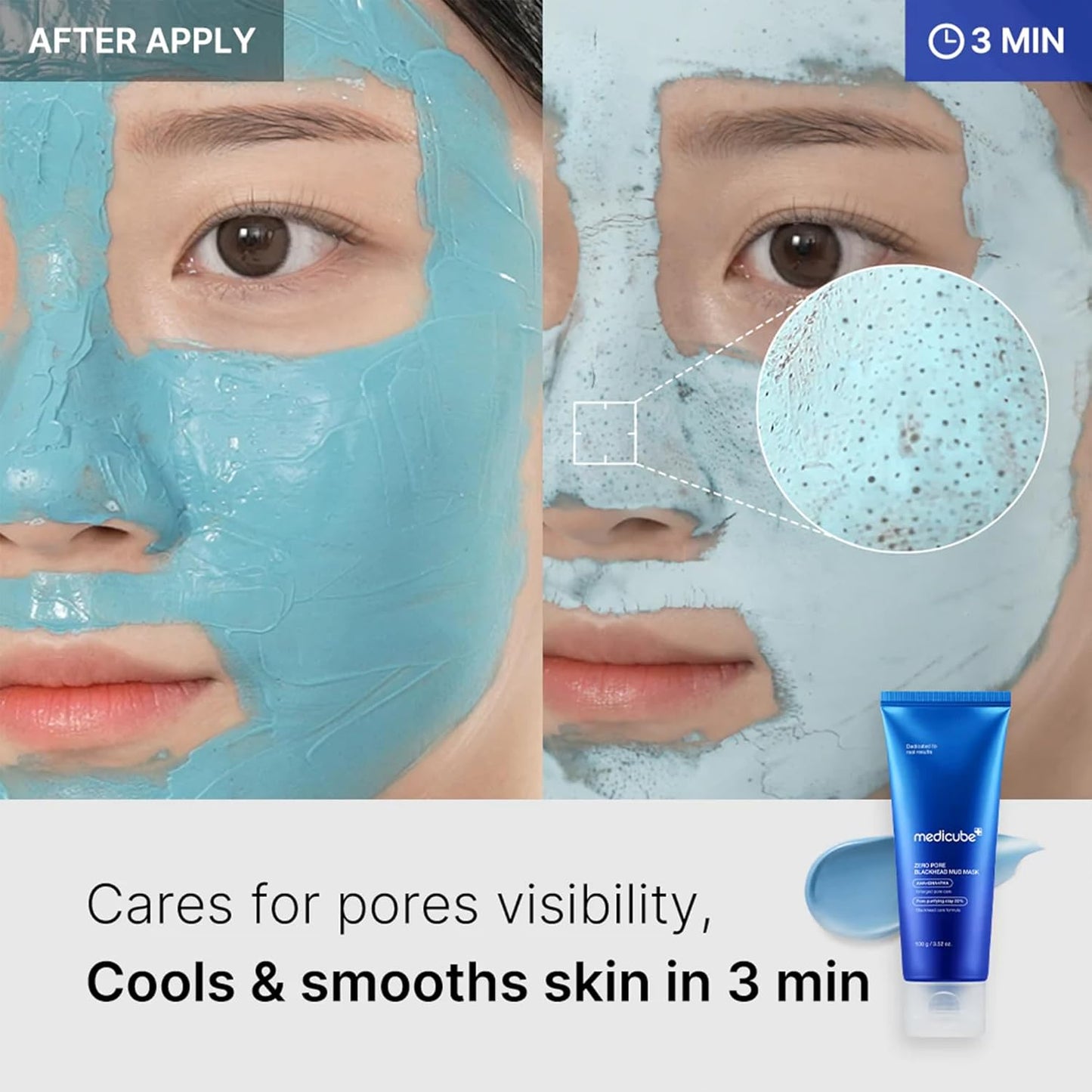 Medicube_Zero_Pore_Blackhead_Mud_Facial_Mask_-_Skin_Cooling_&_Pore_Tightening_-_3_Minute_Quick_Dry_Formula_with_AHA,_BHA,_PHA,_and_Pore-Purifying_Clay_-_Korean_Mud_Mask_3.52_oz