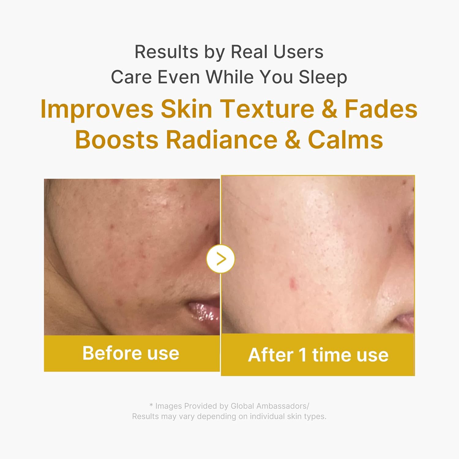 medicube_Wrapping_Mask_Kojic_Acid,_Turmeric,_Vitamin_C_Overnight_Peel_Off_Facial_Mask_|_Brighten_&_Defends_Against_Skin_Stress_for_a_Clear,_Glowing_Complexion_|_Korean_Skin_Care,_2.53_fl.oz