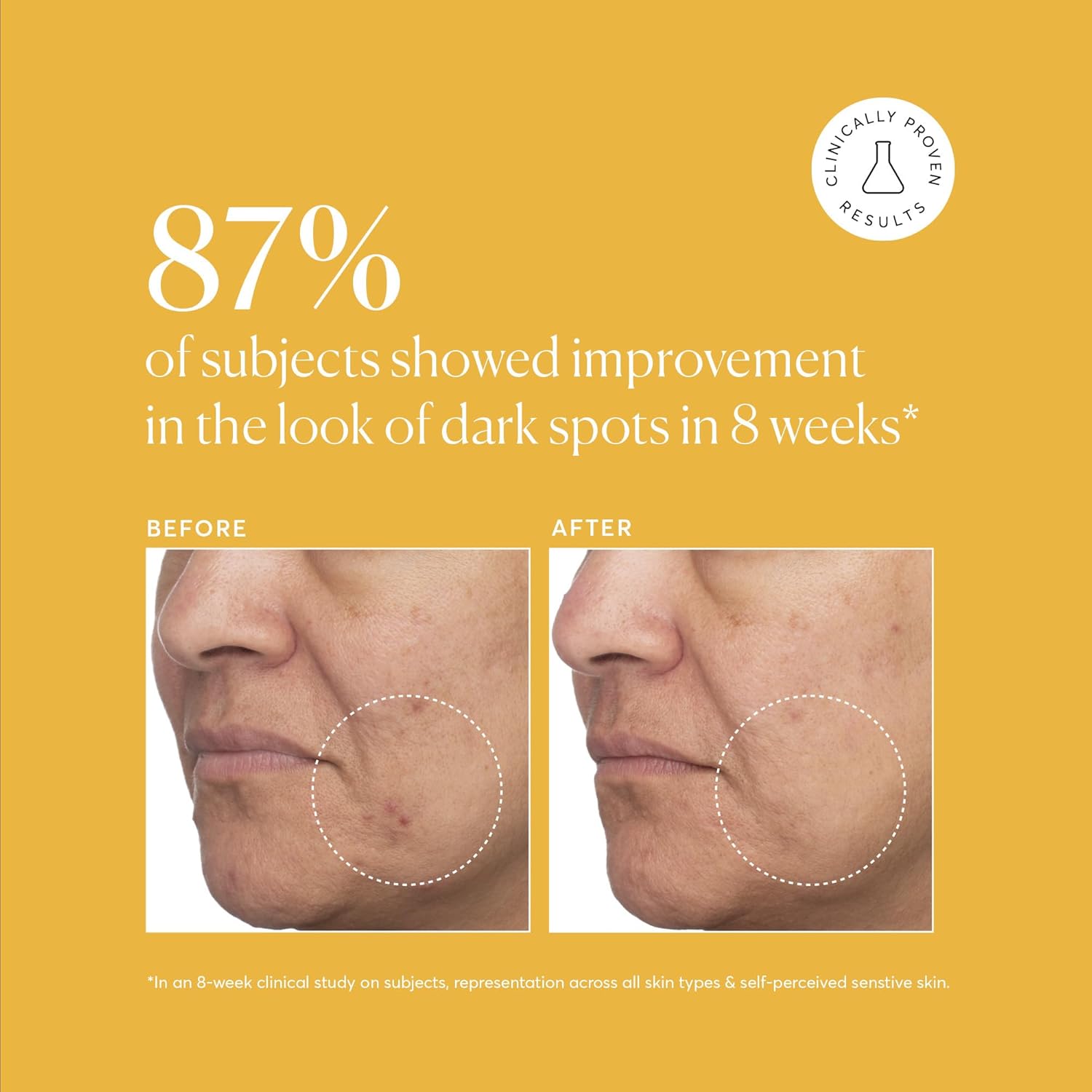 Naturium_Tranexamic_Topical_Acid_5%,_Face_&_Skin_Care,_with_Kojic_Acid,_Niacinamide_&_Licorice_Root,_1_oz