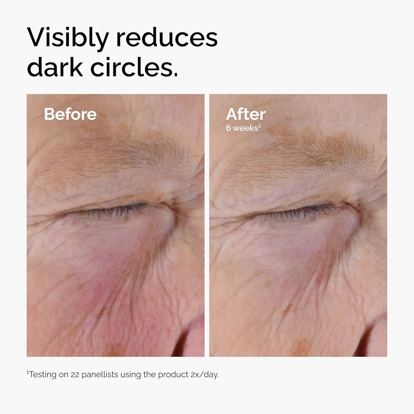 The_Ordinary_Caffeine_Solution_5%_+_EGCG,_Depuffing_Eye_Serum_for_Dark_Circles_and_Tired_Eyes