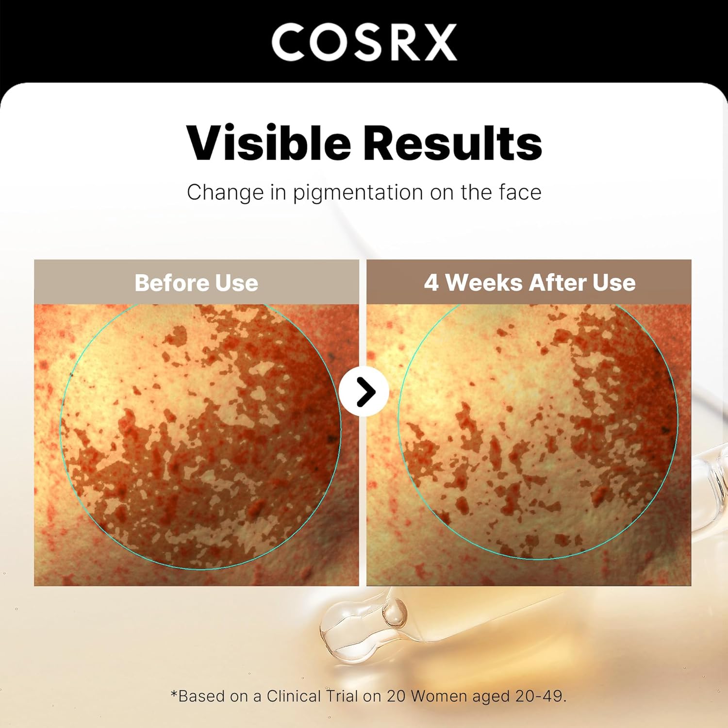 COSRX_2%_Alpha_Arbutin_Discoloration_Care_Face_Serum_with_Niacinamide,_Glutathione_&_Tranexamic_Acid,_Dark_Spot,_Uneven_Tone_Care,_Daily_Korean_Skin_Care,_Mothers_Day_Gifts_for_Woman,_1.7_fl_oz