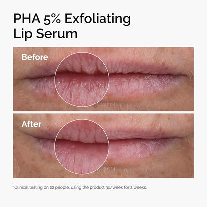 The_Ordinary_PHA_5%_Exfoliating_Lip_Serum,_Hydrating_Overnight_Lip_Exfoliator_Treatment,_0.5_Fl_Oz