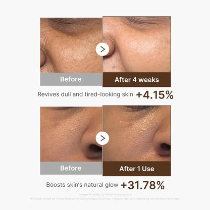 medicube_Deep_Vitamin_C_Capsule_Serum_|_Hydrating_Vitamin_C_Serum_for_Dull_&_Uneven-Looking_Skin_with_Visible_Concerns_|_Liposome_Capsules_for_Smooth,_Radiant_Texture_|_Korean_Skincare_1.01_fl.oz