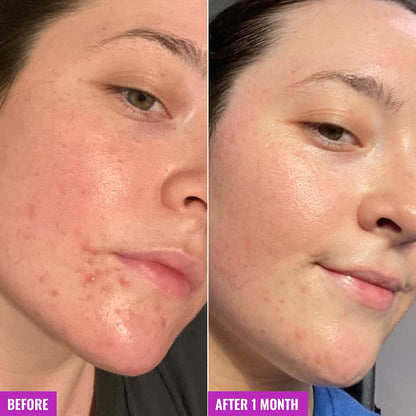 Good_Molecules_Clarify_and_Cleanse_Bar_-_Soap_Free_Bar_with_Salicylic_Acid,_BHA_for_Skin_Tone_Balancing_and_Cleansing_-_Body_and_Facial_Cleanser,_Skin_Care_for_Face