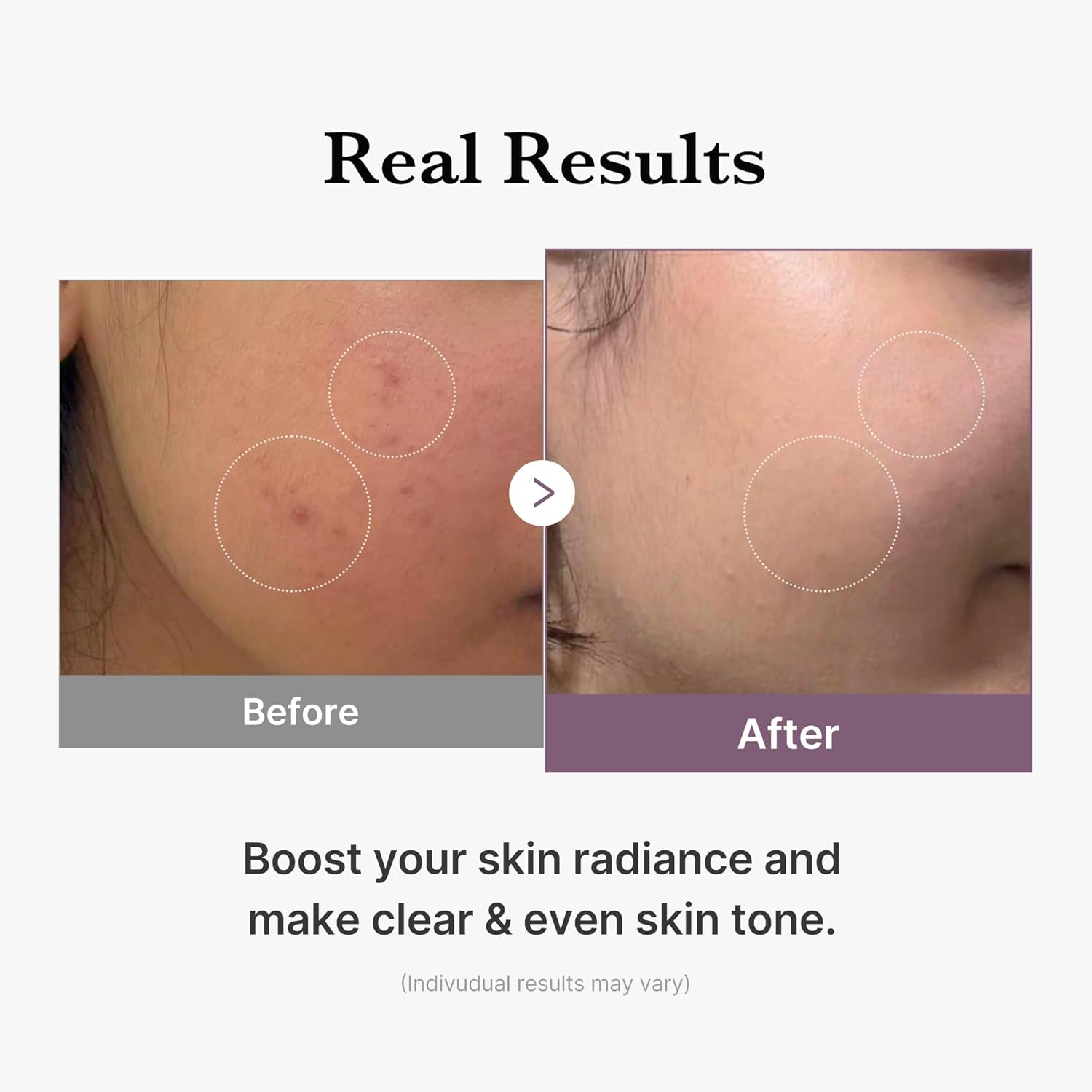 medicube_Age-R_Glutathione_Glow_Milky_Toner,_Low-Irritation_Double_Layer_Toner_for_Glass_Glow_Skin_with_Peptide,_Even_Skin_Tone,_Radiance,_Hydration,_Korean_Skincare