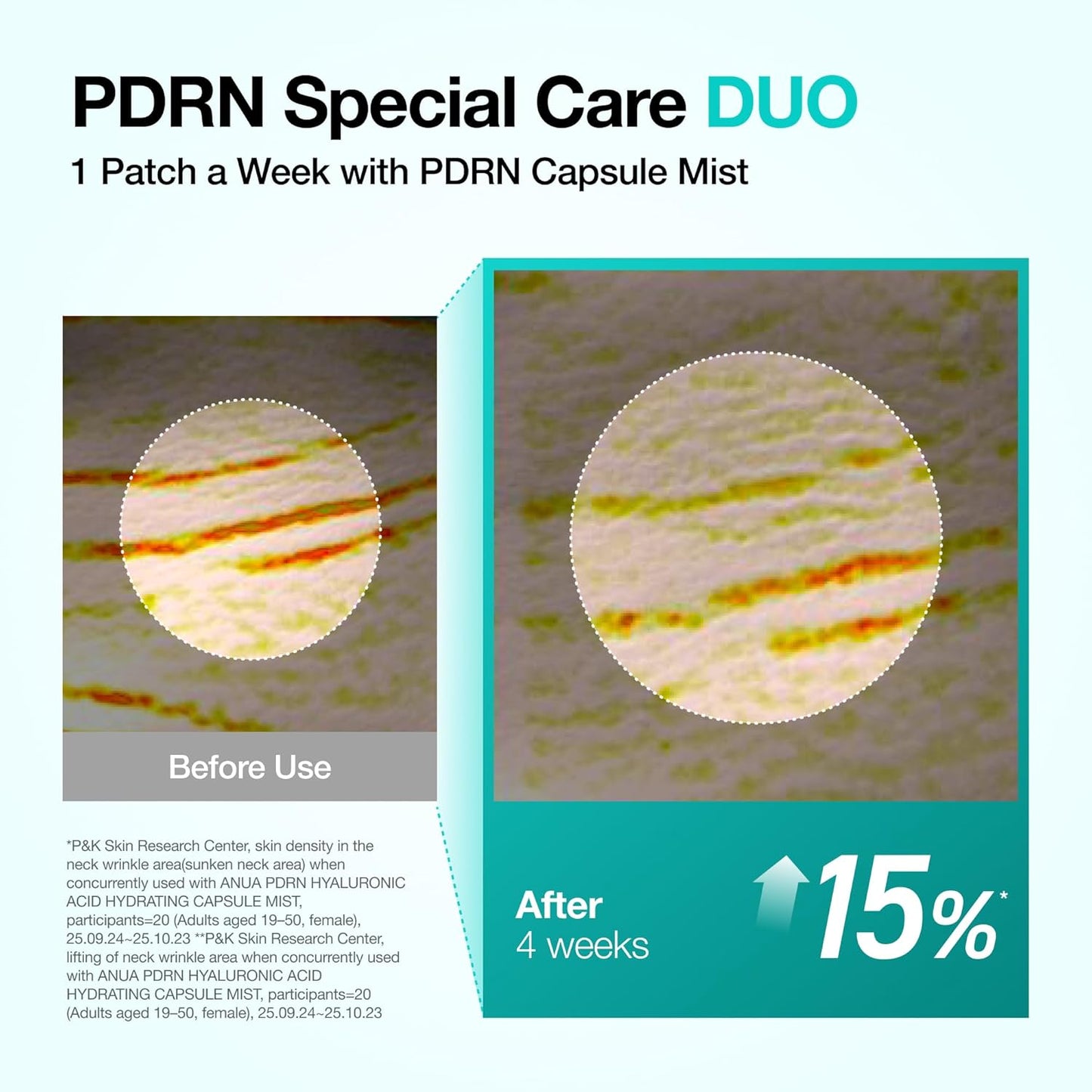 Anua_PDRN_Collagen_Melting_Patch_for_Neck,_Lifting_and_Firming,_Thin_Film_for_Neck_Fine_Lines_&_Forehead,_Plumping_Effect_with_Salmon_DNA,_Korean_Skincare,_0.02g_x_4EA,_Patch_Only