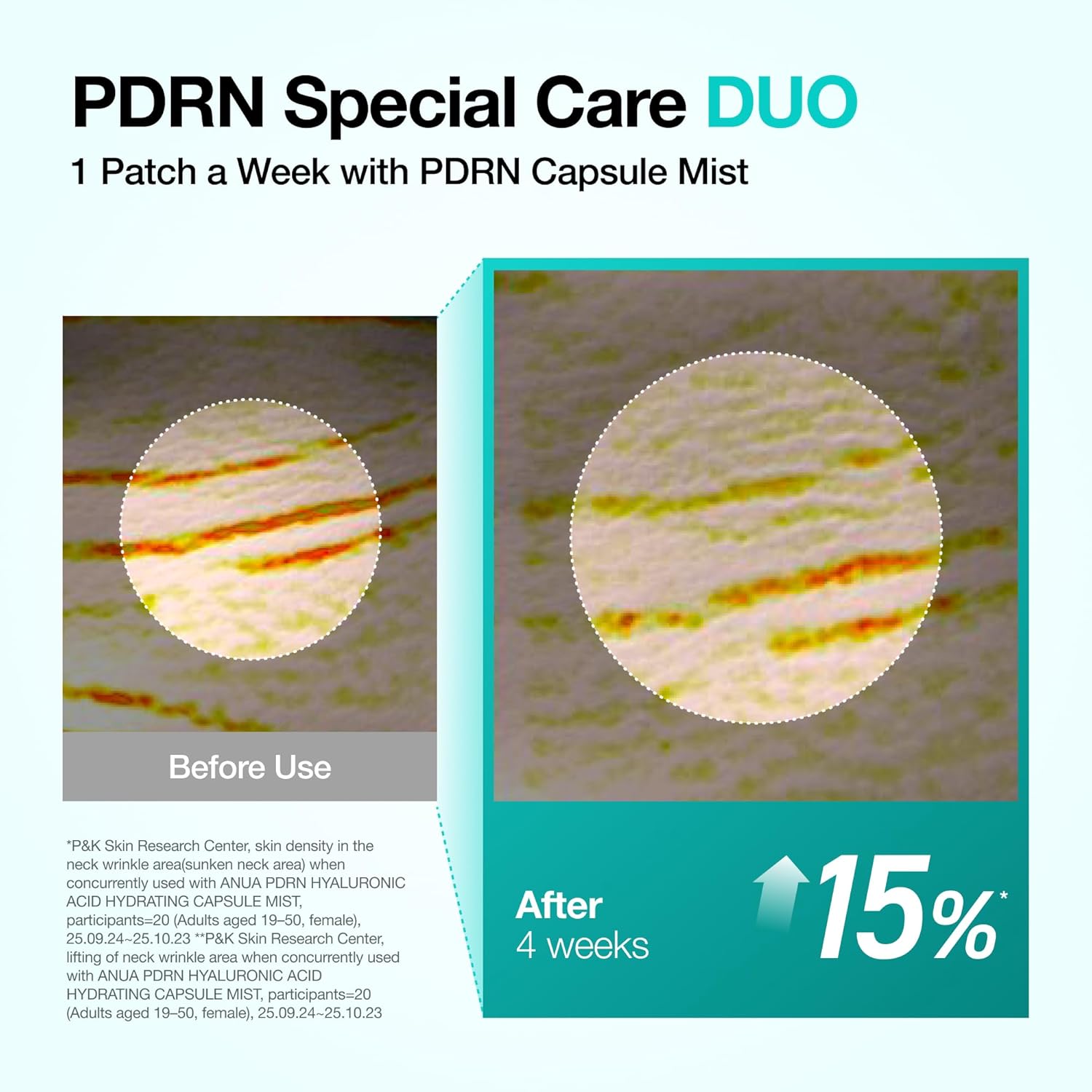 Anua_PDRN_Collagen_Melting_Patch_for_Neck,_Lifting_and_Firming,_Thin_Film_for_Neck_Fine_Lines_&_Forehead,_Plumping_Effect_with_Salmon_DNA,_Korean_Skincare,_0.02g_x_4EA,_Patch_Only