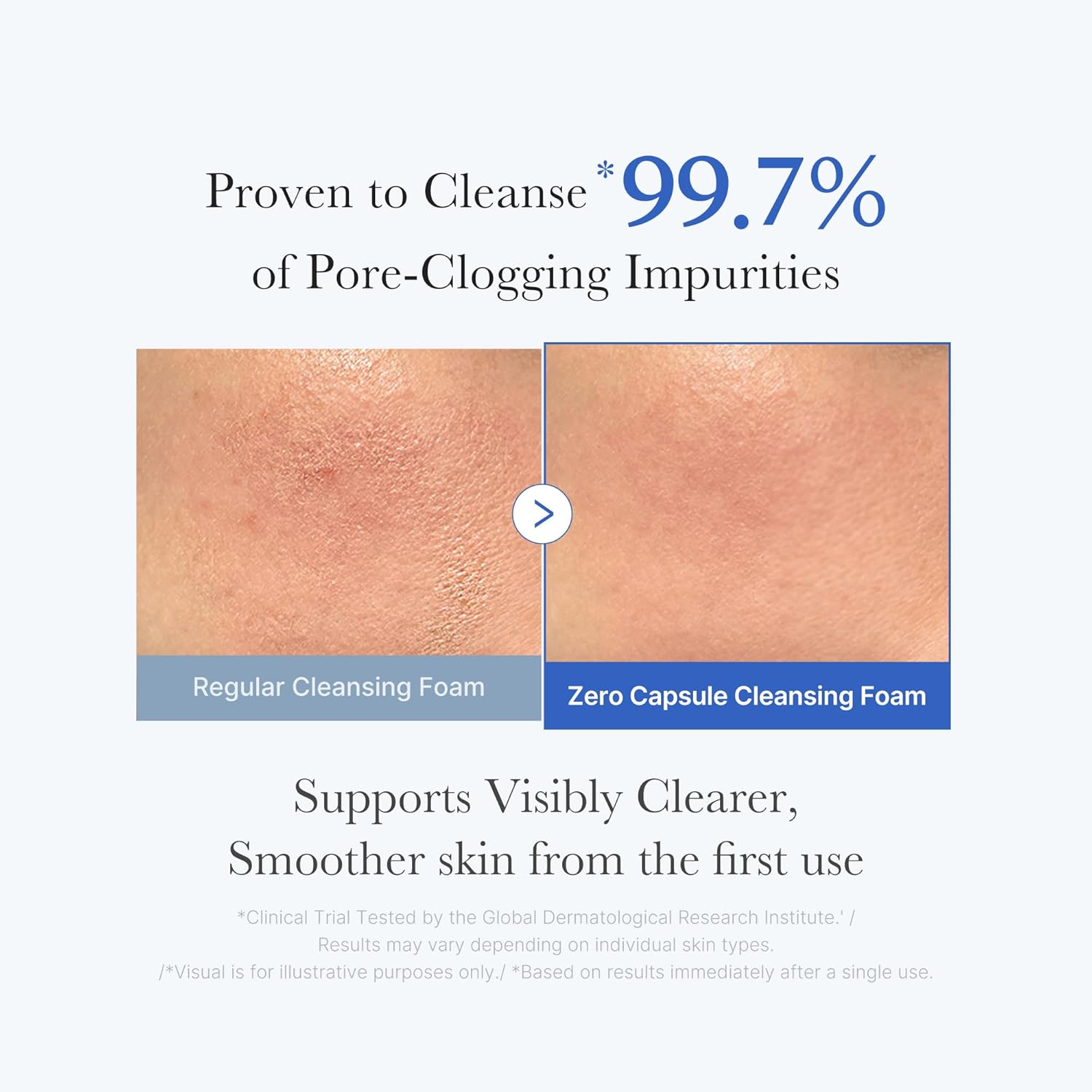 medicube_Facial_Cleanser_Zero_Pore_Capsule_Cleansing_Foam_|_Daily_Gentle_Cleanser_for_Skin_Texture,_Blackhead_&_Pore_Care_|_AHA,_BHA_&_PHA_for_Deep_Cleansing_|_Korean_Skincare,_4.23_oz