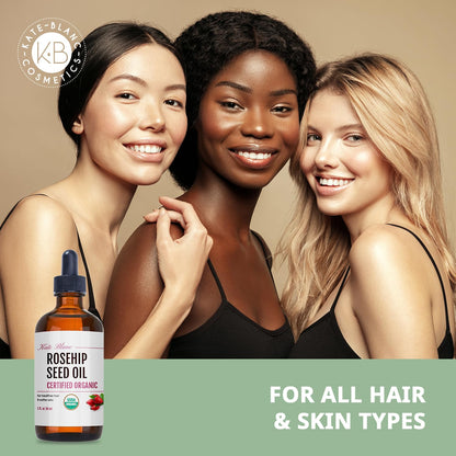 Kate_Blanc_Cosmetics_Rosehip_Seed_Oil_for_Face,_100%_Pure_Organic_|_Cold_Pressed_Unrefined_Rose_Hip_Facial_Oil_for_Skin,_Hair_&_Gua_Sha_Massage_(1oz)