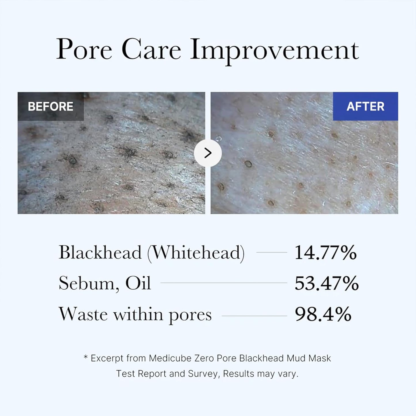 Medicube_Zero_Pore_Blackhead_Mud_Facial_Mask_-_Skin_Cooling_&_Pore_Tightening_-_3_Minute_Quick_Dry_Formula_with_AHA,_BHA,_PHA,_and_Pore-Purifying_Clay_-_Korean_Mud_Mask_3.52_oz