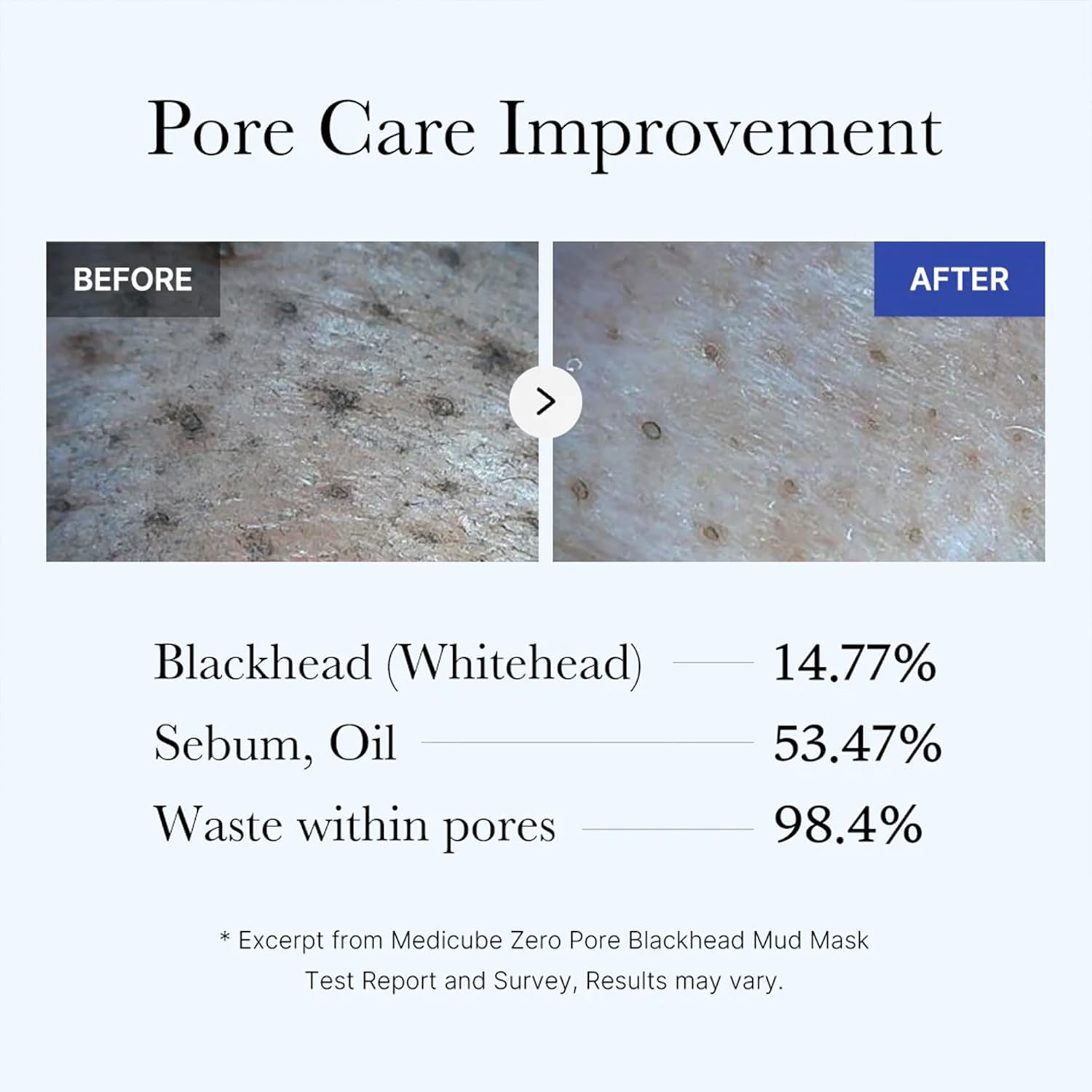 Medicube_Zero_Pore_Blackhead_Mud_Facial_Mask_-_Skin_Cooling_&_Pore_Tightening_-_3_Minute_Quick_Dry_Formula_with_AHA,_BHA,_PHA,_and_Pore-Purifying_Clay_-_Korean_Mud_Mask_3.52_oz