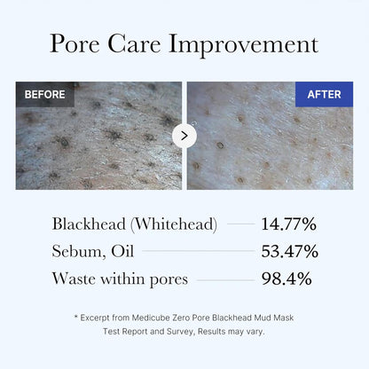Medicube_Zero_Pore_Blackhead_Mud_Facial_Mask_-_Skin_Cooling_&_Pore_Tightening_-_3_Minute_Quick_Dry_Formula_with_AHA,_BHA,_PHA,_and_Pore-Purifying_Clay_-_Korean_Mud_Mask_3.52_oz