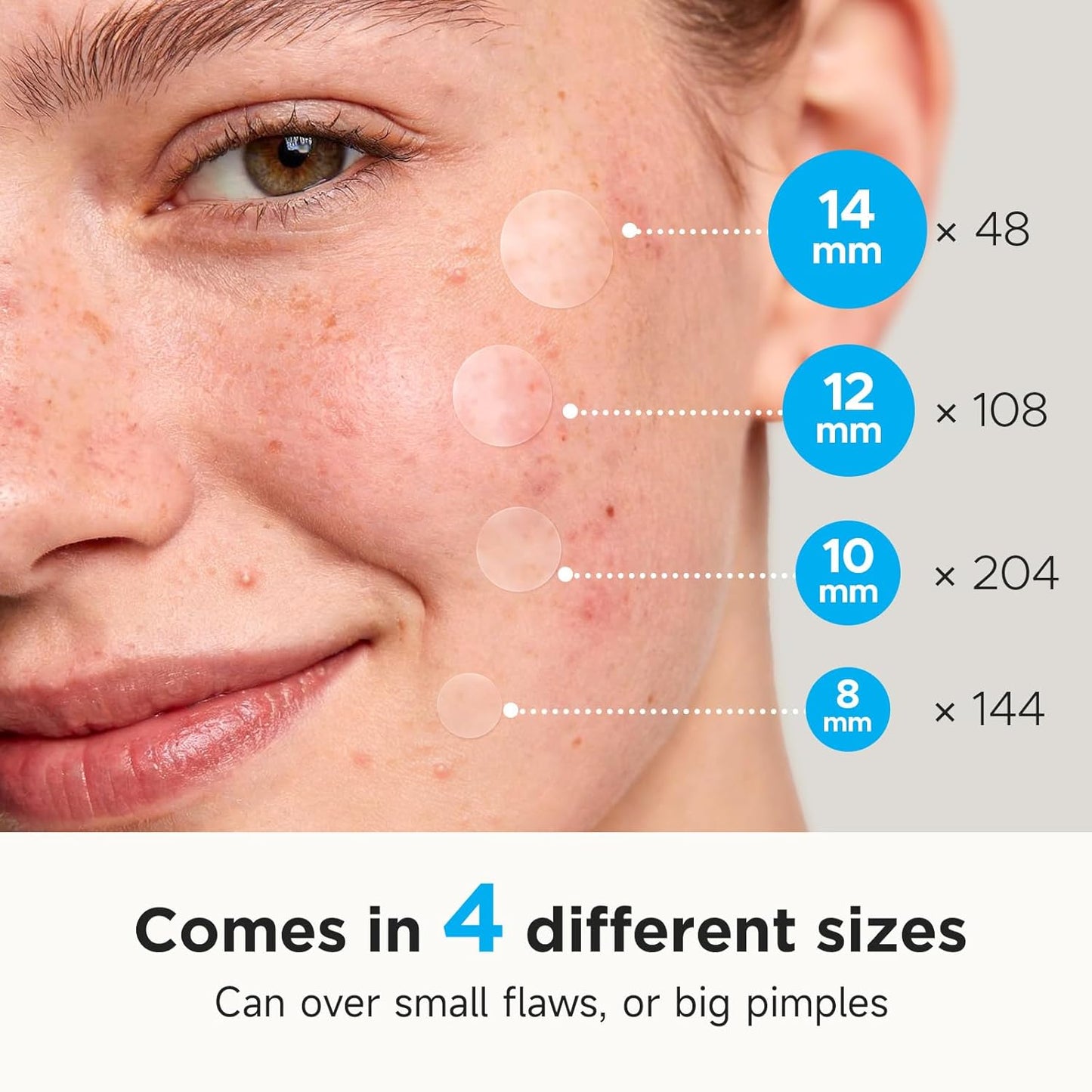 Pimple_Patches_for_Face_(504_Count),_FSA_Eligible_Acne_Patch_Bulk,_Zit_Stickers_4_Sizes,_Hydrocolloid_Spot_Stickers,_Clear_Acne_Dots_for_Covering_Zits,_Blemishes_and_Breakouts