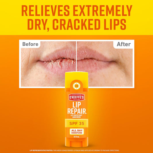 O'Keeffe's_Lip_Repair_SPF_35_Lip_Balm_-_Stick_(1_Pack)_-_Sun-Safe_Moisturizer_for_Extremely_Cracked,_Dry_Lips
