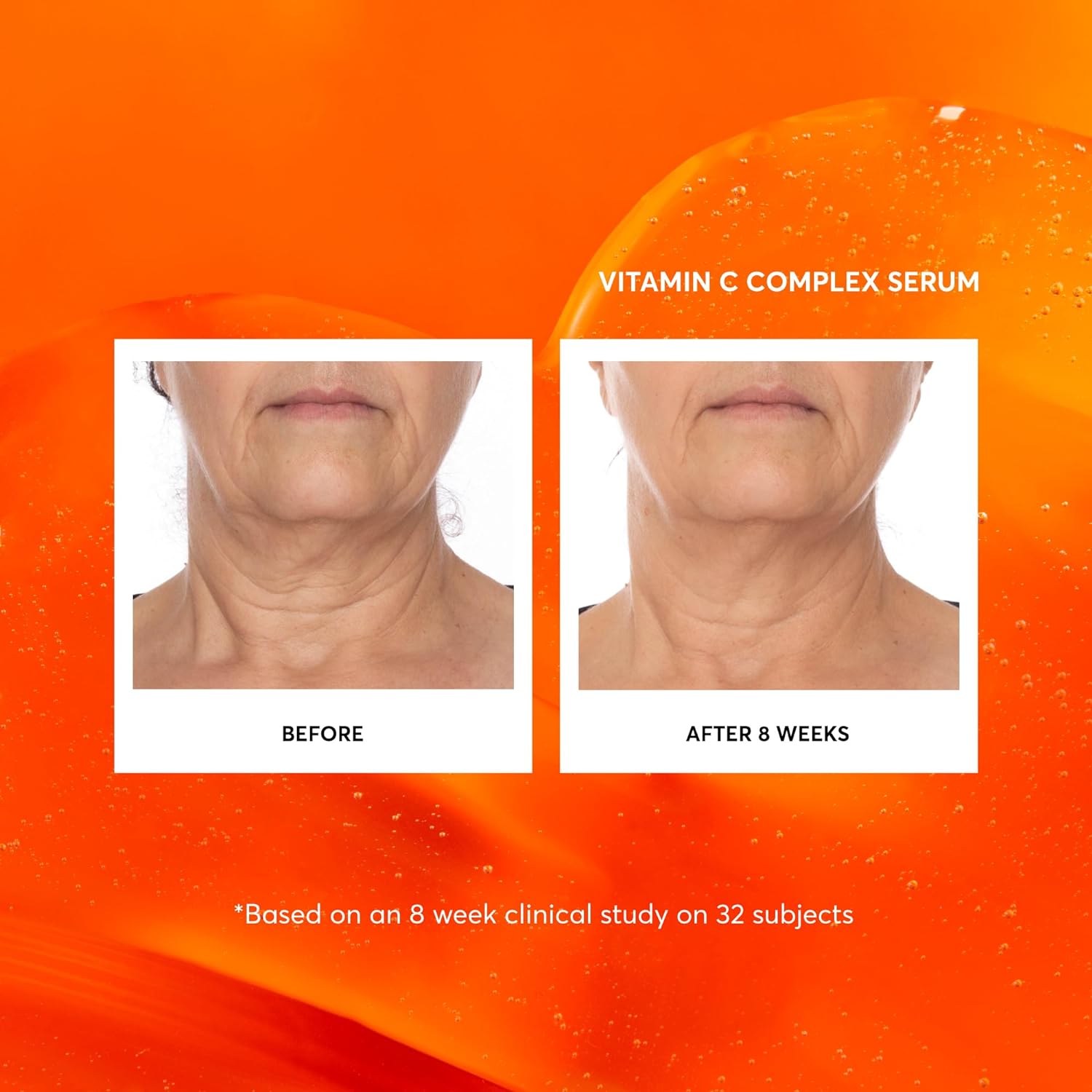 Naturium_Vitamin_C_Complex_Face_Serum_Jumbo,_Anti-Aging_Facial_Treatment_with_Hyaluronic_Acid_&_Vitamin_E,_2_oz