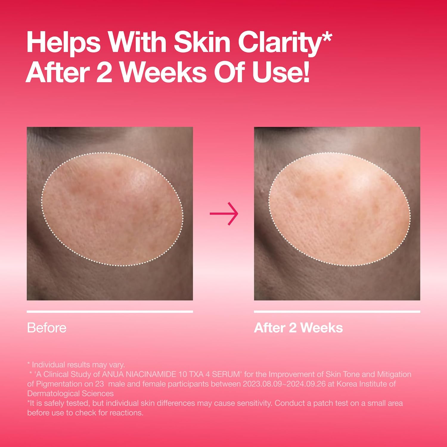 Anua_Niacinamide_10_+_TXA_4_Serum,_Dark_Spot_Care,_Hyaluronic_Acid,_Tranexamic_Acid,_Lightweight_&_Hydrating_All-in-One_Daily_Facial_Serum_for_Glass_Skin,_Korean_Skincare,_1.01_fl.oz