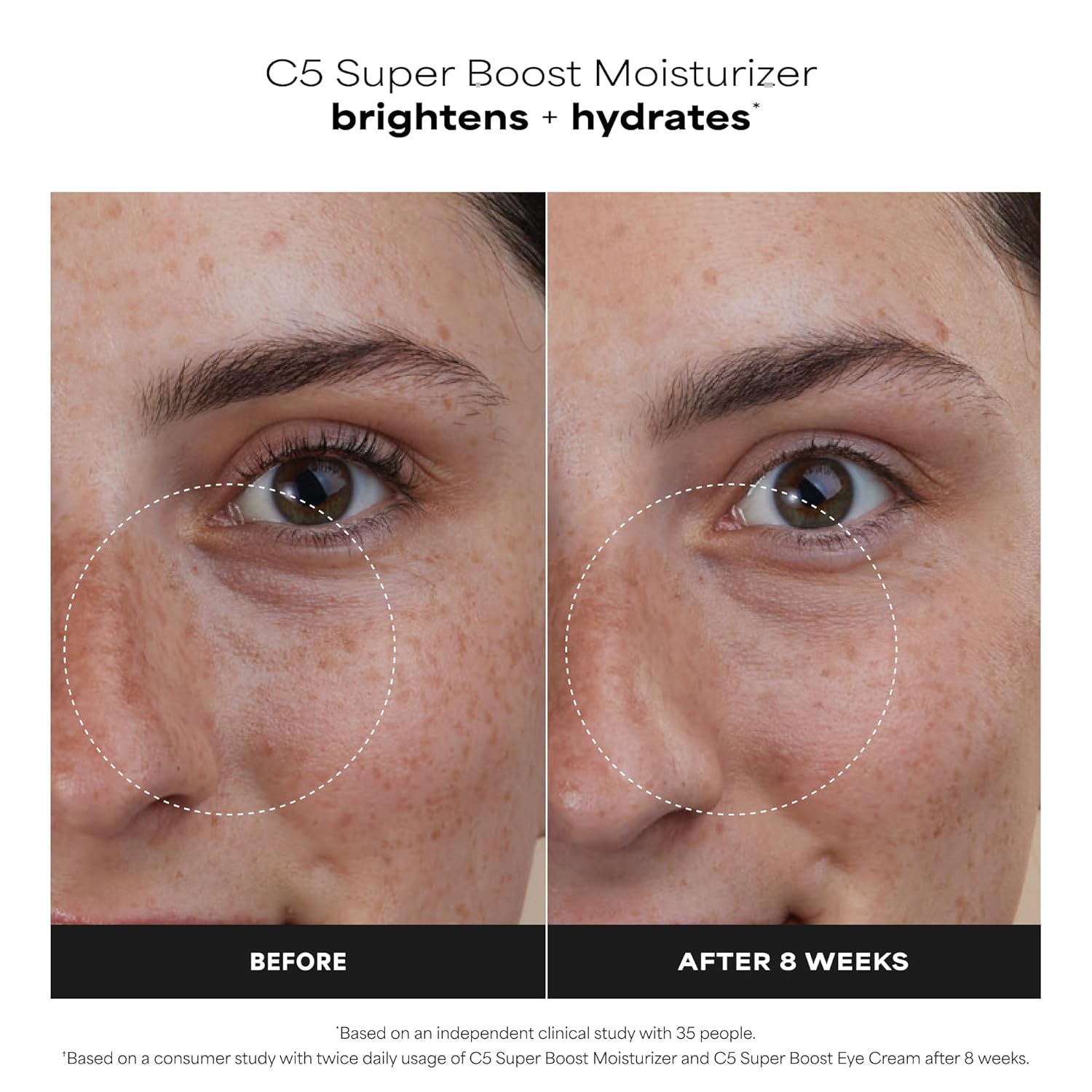 Paula's_Choice_C5_Super_Boost_Face_Moisturizer_with_5%_Vitamin_C_&_Squalane,_Daily_Face_Lotion_for_Discoloration,_Uneven_Tone,_Fine_Lines_&_Breakout-Prone_Skin,_Fragrance-Free