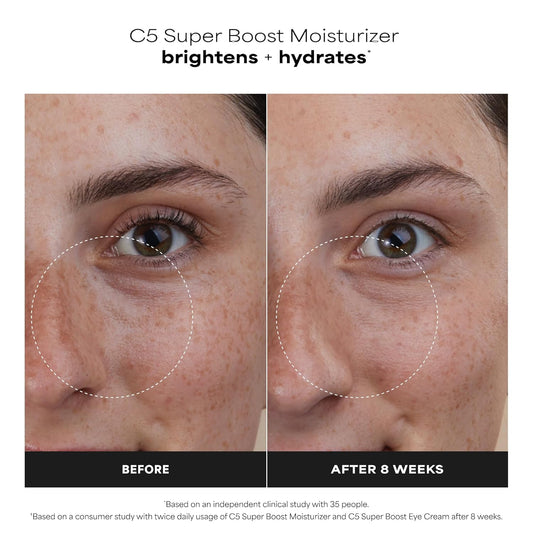 Paula's_Choice_C5_Super_Boost_Face_Moisturizer_with_5%_Vitamin_C_&_Squalane,_Daily_Face_Lotion_for_Discoloration,_Uneven_Tone,_Fine_Lines_&_Breakout-Prone_Skin,_Fragrance-Free