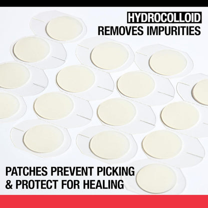 Neutrogena_Stubborn_Acne_Ultra-Thin_Patches_for_Acne-Prone_Skin_-_Hydrocolloid_Overnight_Blemish_Patch_for_Clear_Skin,_24_Patches