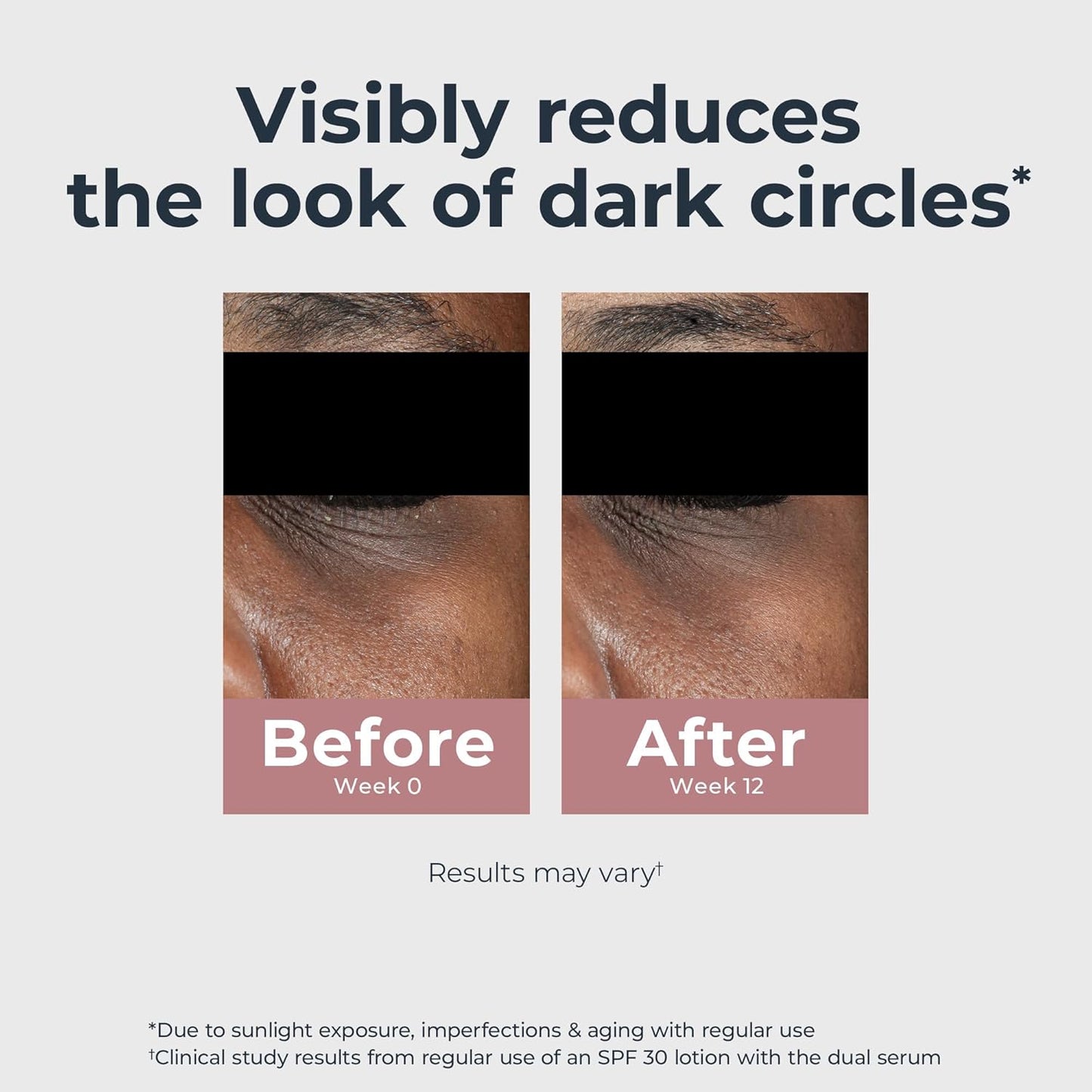 Eucerin_Radiant_Tone_Eye_Cream_Dark_Circle_Corrector,_Eye_Brightening_Cream_with_Thiamidol_and_Hyaluronic_Acid,_Helps_Reduce_the_Look_of_Eye_Puffiness,_0.5_Oz_Tube