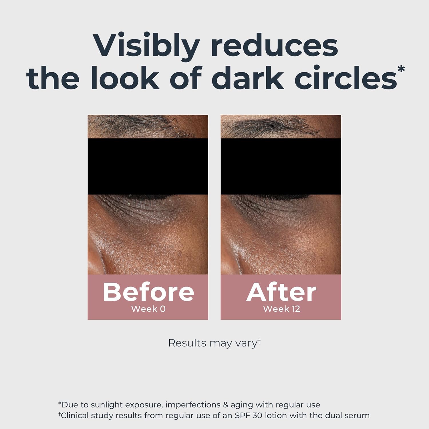 Eucerin_Radiant_Tone_Eye_Cream_Dark_Circle_Corrector,_Eye_Brightening_Cream_with_Thiamidol_and_Hyaluronic_Acid,_Helps_Reduce_the_Look_of_Eye_Puffiness,_0.5_Oz_Tube