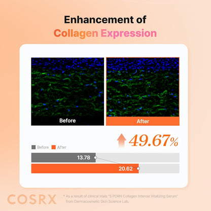 COSRX_5_PDRN_Collagen_Intense_Vitalizing_Serum_-_Korean_Serum_for_Skin_Firming_&_Glowing_with_Salmon_DNA,_Centella_PDRN_&_Collagen,_Mothers_day_gifts,_Korean_Skin_Care_(3.38_fl.oz.)