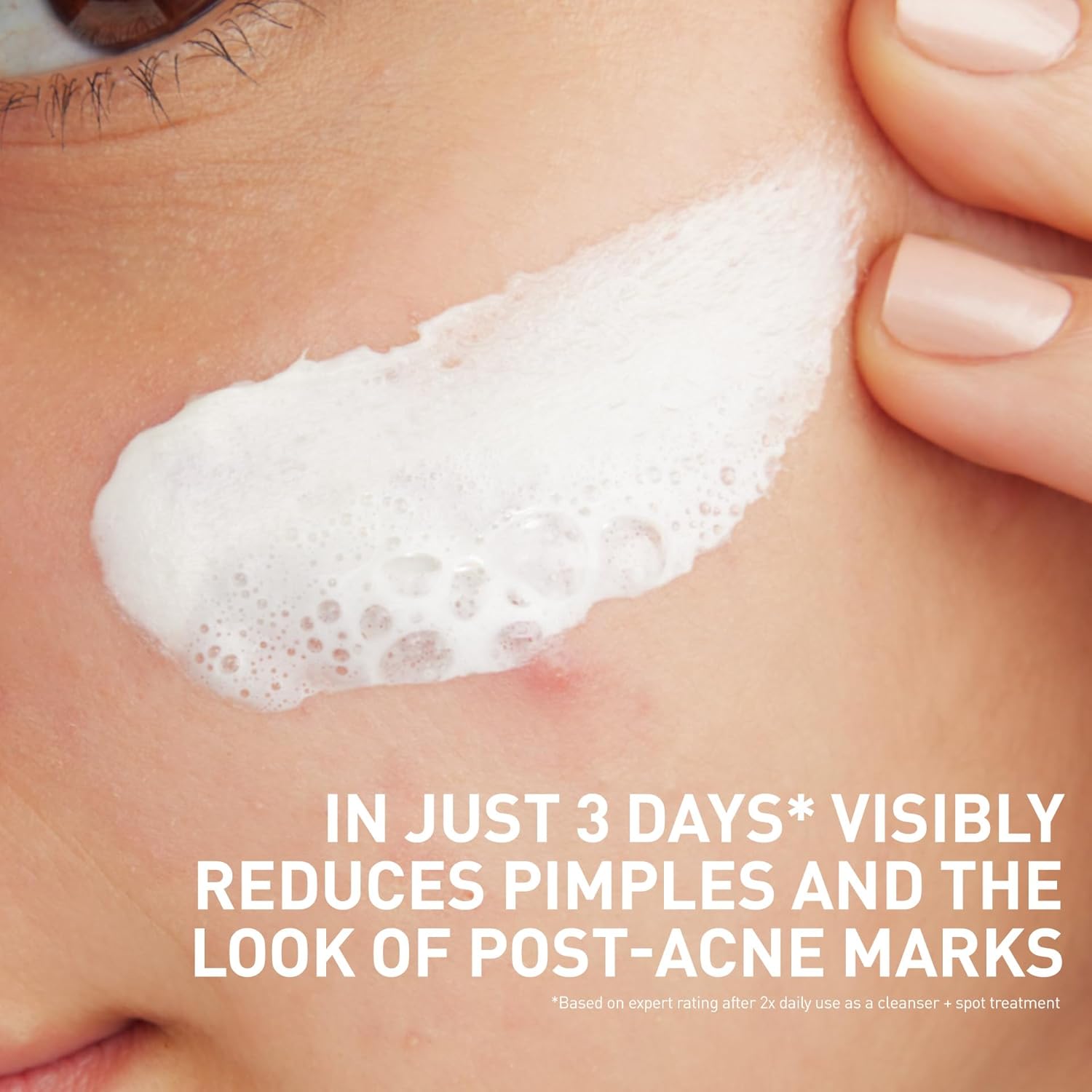 CeraVe_Clay_To_Foam_Acne_Face_Wash,_Multi-Use_Salicylic_Acid_&_Kaolin_Clay_Acne_Spot_Treatment_Clears_Pimples_&_Blackheads,_Prevents_Breakouts,_Hydrates_&_Soothes,_Fragrance-Free,_Non-Comedogenic,_4oz