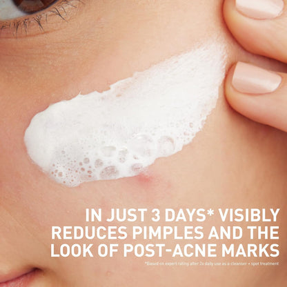 CeraVe_Clay_To_Foam_Acne_Face_Wash,_Multi-Use_Salicylic_Acid_&_Kaolin_Clay_Acne_Spot_Treatment_Clears_Pimples_&_Blackheads,_Prevents_Breakouts,_Hydrates_&_Soothes,_Fragrance-Free,_Non-Comedogenic,_4oz