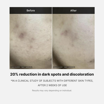 Medicube_Deep_Vita_C_Serum_2.0_||_14.5%_Pure_Vitamin_C_reduce_the_appearance_of_hyperpigmentation,_dark_spots,_and_blemishes_|_16_self-tests_complete_|_Korean_skincare_(10g_*_3_bottles)