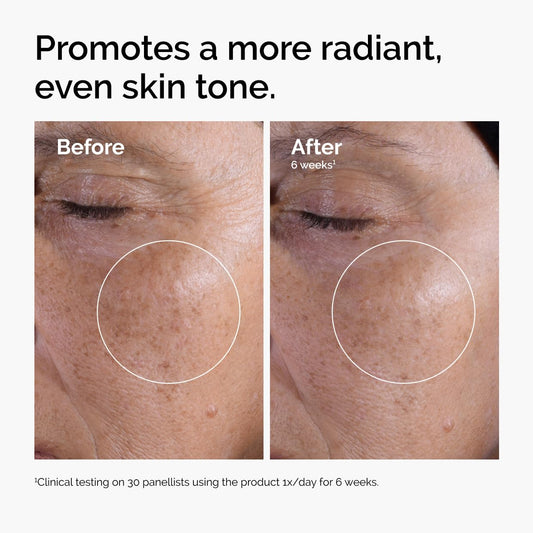 The_Ordinary_Glycolic_Acid_7%_Exfoliating_Toner,_Brightening_and_Smoothing_Daily_Toner_for_More_Even-Looking_Skin_Tone