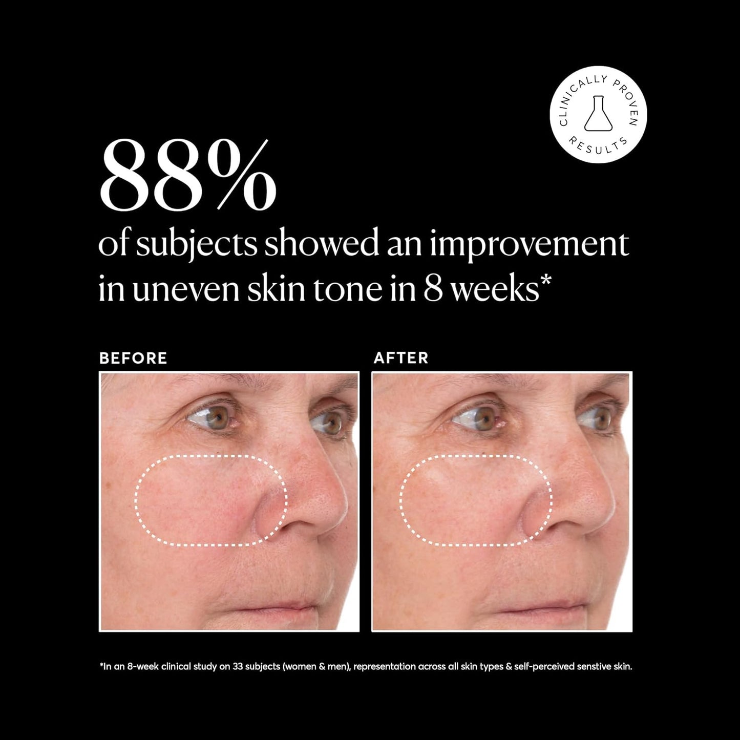 Naturium_Vitamin_C_Super_Serum_Plus,_Smoothing_Face_Care,_plus_Retinol,_Hyaluronic_Acid,_Niacinamide_&_Salicylic_Acid,_1_oz