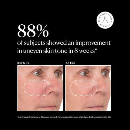 Naturium_Vitamin_C_Super_Serum_Plus,_Smoothing_Face_Care,_plus_Retinol,_Hyaluronic_Acid,_Niacinamide_&_Salicylic_Acid,_1_oz