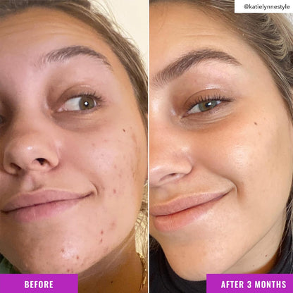 Niacinamide_Brightening_Toner_-_Facial_Toner_with_Niacinamide,_Vitamin_C_and_Arbutin_for_Even_Tone,_Enlarged_Pores_-_Skincare_for_Face