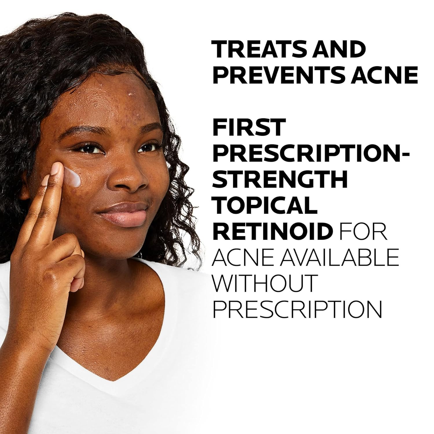 La_Roche-Posay_Effaclar_Adapalene_Gel_0.1%_Acne_Treatment,_Retinoid_Cream,_Acne_Medication_Gel_for_Blackheads_&_Whiteheads,_Oil_Free,_Helps_Clear_and_Prevent_Blemishes_&_Clogged_Pores
