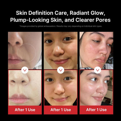 medicube_Booster_Pro_|_6-in-1_Real_Glass_Glow_Beauty_Massager_|_for_Clear,_Radiant,_Firmer-Looking_Skin_|_Korean_Skin_Care_|_Black