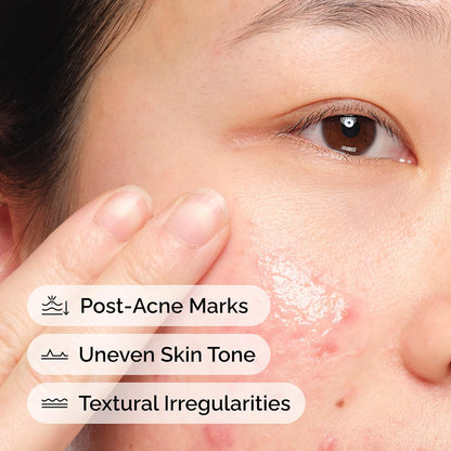 The_Ordinary_Aloe_2%_+_NAG_2%_Solution,_Soothes_Skin_and_Targets_Post-Acne_Marks,_1_Fl_Oz